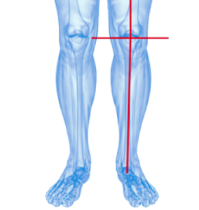 protesi-ginocchio-home